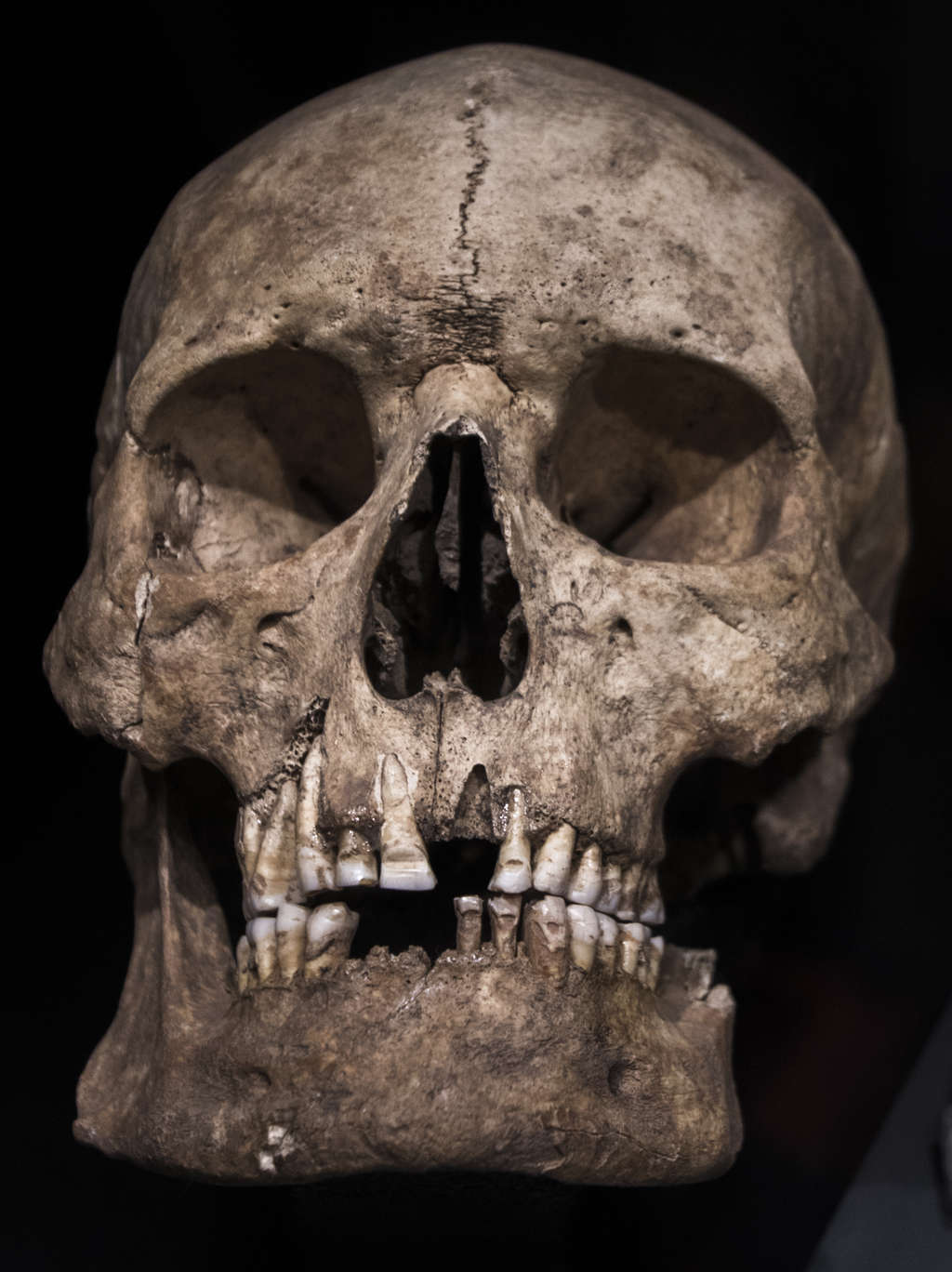 Male Skull